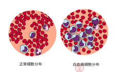 中性杆状核粒细胞(中性粒细胞核杆状核)