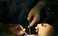 腹膜外剖宫产(剖宫产腹膜外手术)
