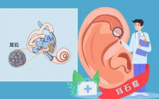 耳石症是怎么回事(耳石症跟什么有关)